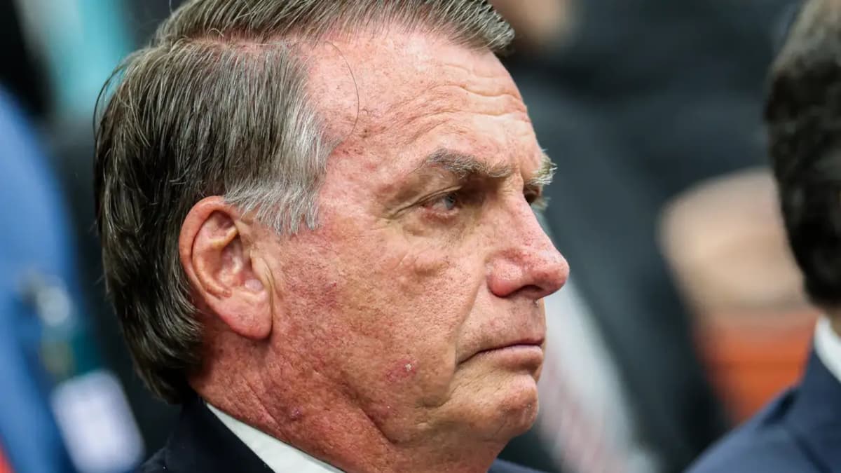 Defesa pede ao STF autorização para Bolsonaro passar por cirurgia em Brasília